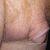 4inchcut