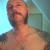 skin40